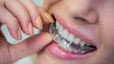 Why Invisalign Is a Better Option
