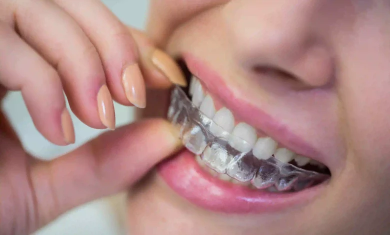 Why Invisalign Is a Better Option